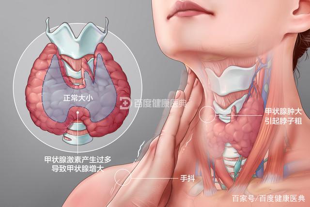 認(rèn)識(shí)甲狀腺疾病的古今